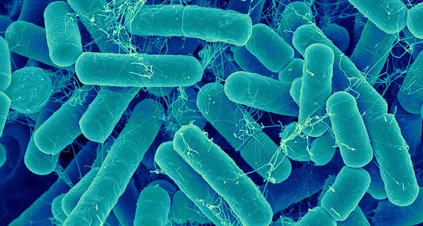 Packaging and Storage - Bacteria Elimination 消除细菌